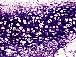 <p>what type of cartilage is this?</p>