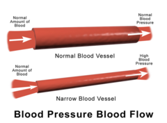<p>mạch máu thu hẹp fatty foods can narrow blood vessels</p>
