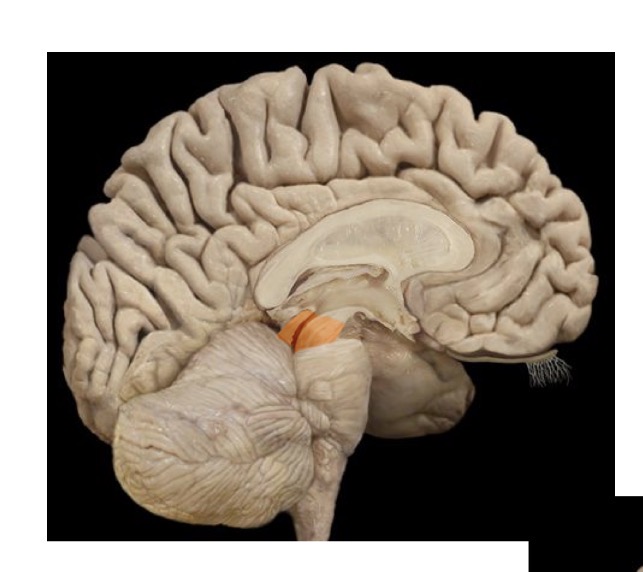 <p>what is this (remember above the pons on the model)</p>