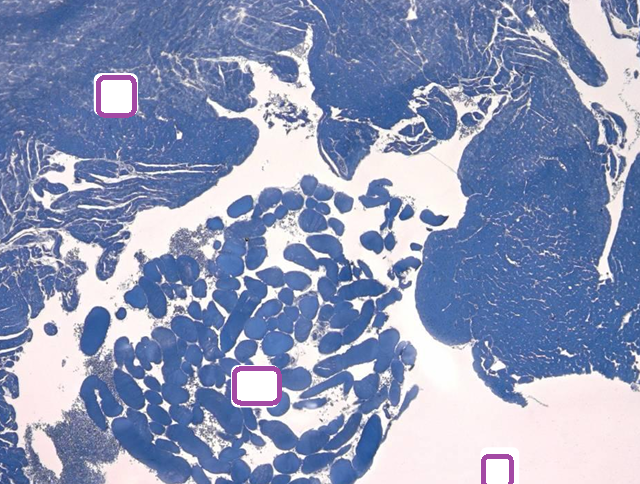 <p>label the parts of the cardiac muscle</p>