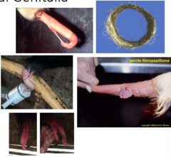 <p>Warts</p><p>Hair ring</p><p>Persistent frenulum</p><p>Corkscrew penis</p><p>Diphallus, etc</p>