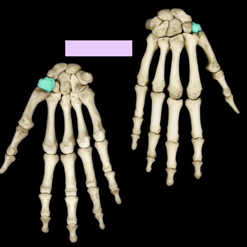 <p>What structure is highlighted?</p>
