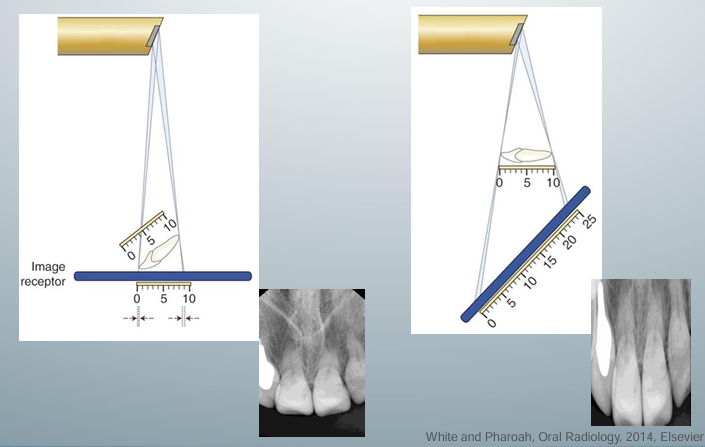 <p>-occurs when the object and receptor are not parallel to each other</p><p>-foreshortening: happens when the central x-ray beam is perpendicular to the image receptor, but the object is not parallel with the image receptor</p><p>-elongation: happens when the central x-ray beam is perpendicular to the object but not to the image receptor</p>