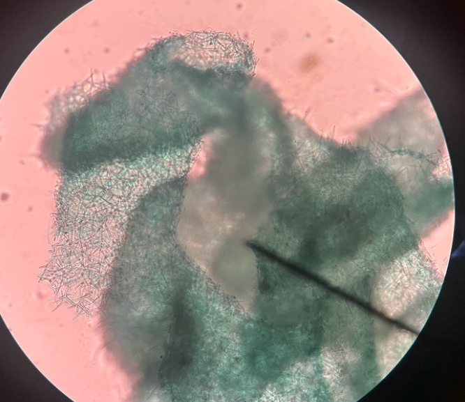 <p>What is this? What class and phylum is it part of?</p>