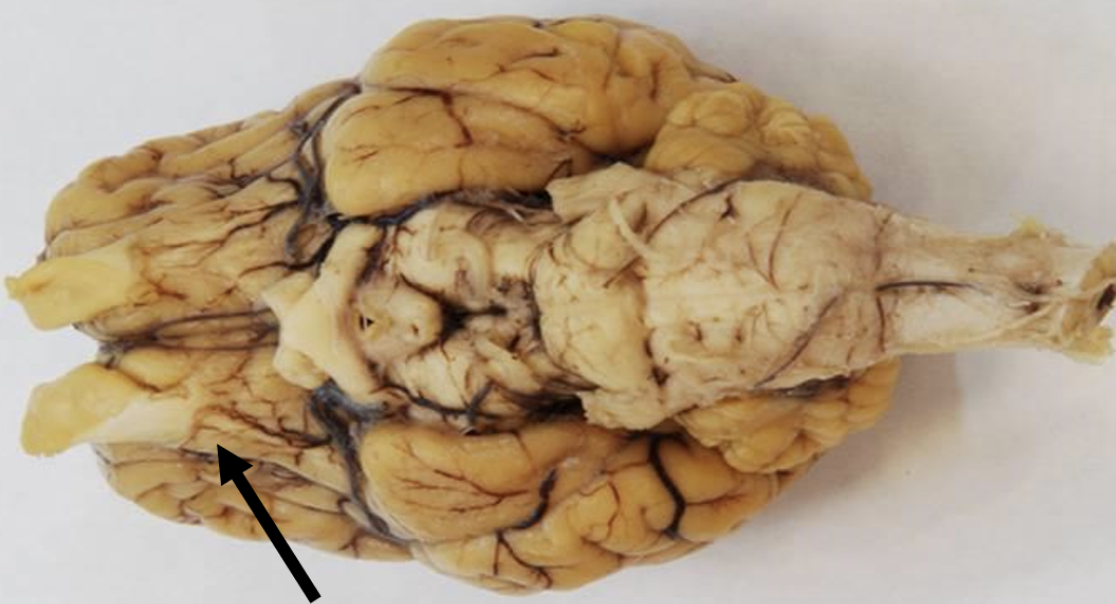 <p>Identify the structure indicated by the pointer.</p>