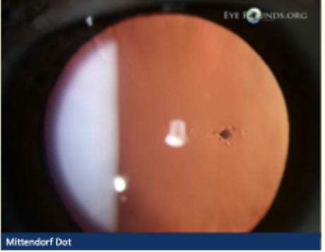 <p>Describe and give diagnosis </p>