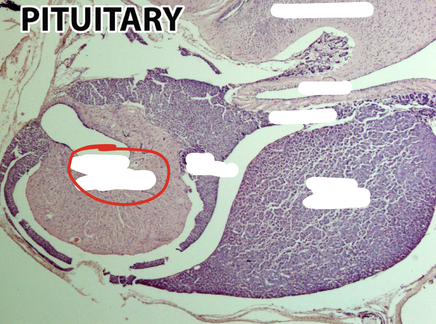 <p>Which part of the pituitary gland is this?</p>