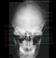 <p>What bone is labeled 4?</p>