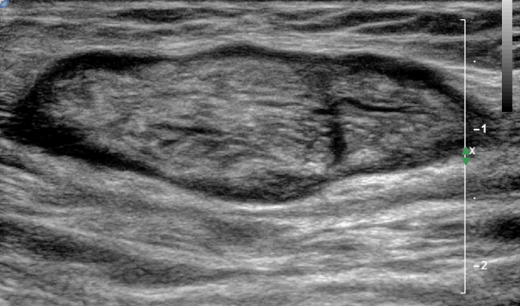 <p>Name the pathology </p>