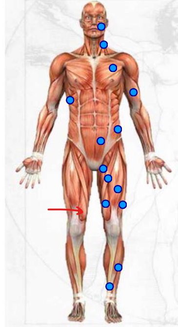 <p>inner muscle right above the knee </p>