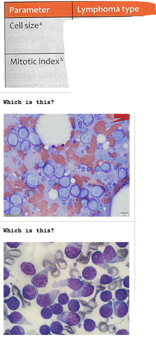 <p>Lymphoma Grade</p>