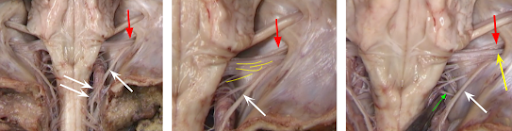 <p>exit point around the tip of the 2 white arrows (the sapce):</p><p>Below the hole:</p><p>Other white arrow:</p><p>Exit point/hole:</p><p>yellow arrow:</p><p>the nerves through the hole:</p><p>red:</p>