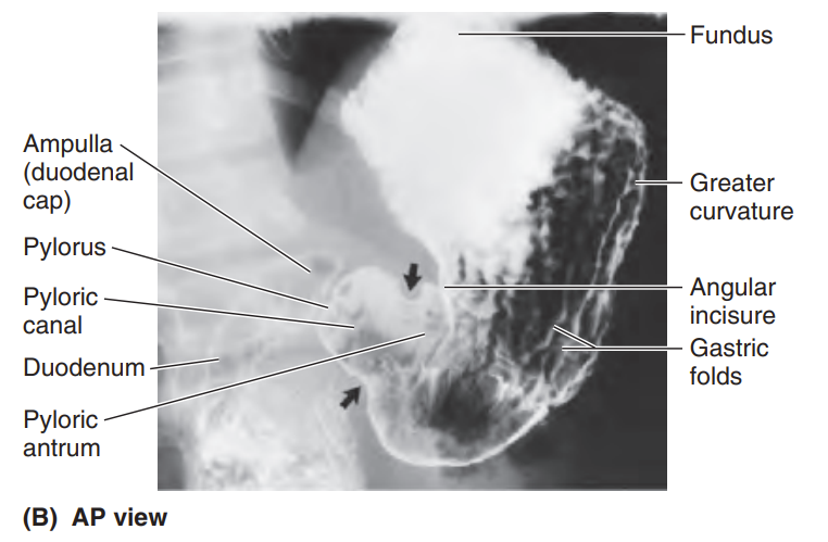 knowt flashcard image