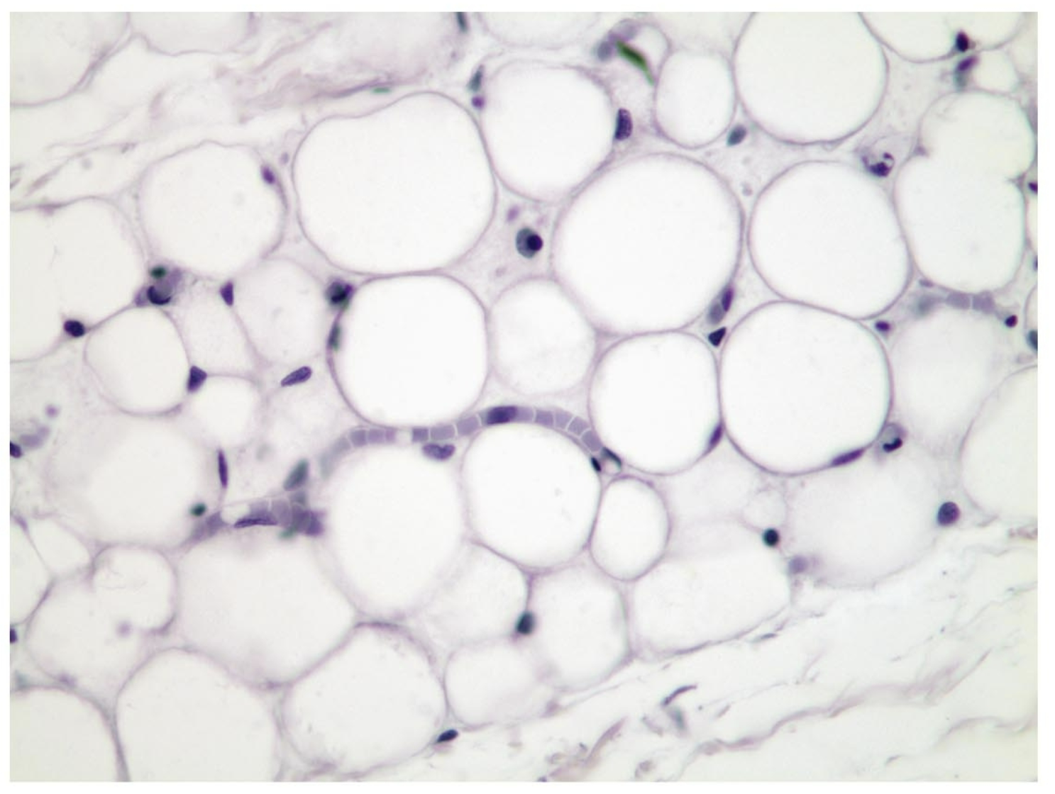 <p>what tissue is this</p>