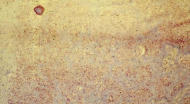 term image
