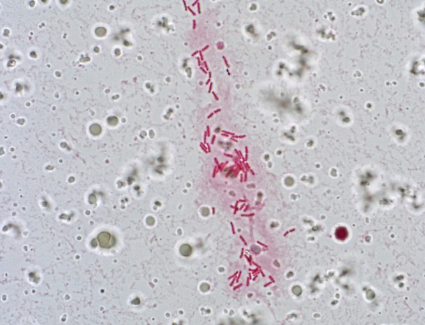 term image