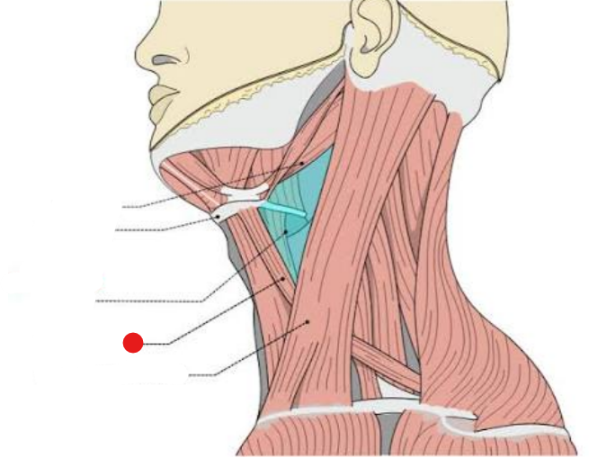 <p>Identify the structure pinned</p>