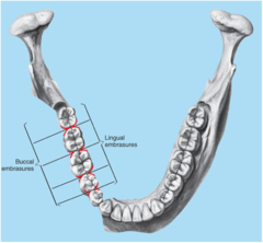 <p>The spaces between teeth that are occlusal to the contact areas.</p>