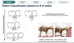 <p>Combination-type osseous defect</p>