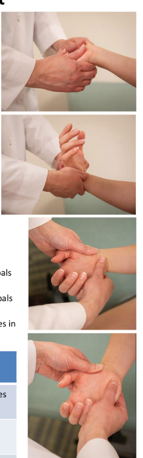 <ol><li><p>test active ROM bilateral</p></li><li><p>Put thumbs on anterior/palmar surface of proximal carpals. On backside, fingers are monitoring posteriorly.</p></li><li><p>Compare side to side with wrist flexion and extension</p></li><li><p>Now do radial and ulnar deviation.</p></li><li><p>On practical just need to name one of the SD if you find two.</p></li></ol><p></p>