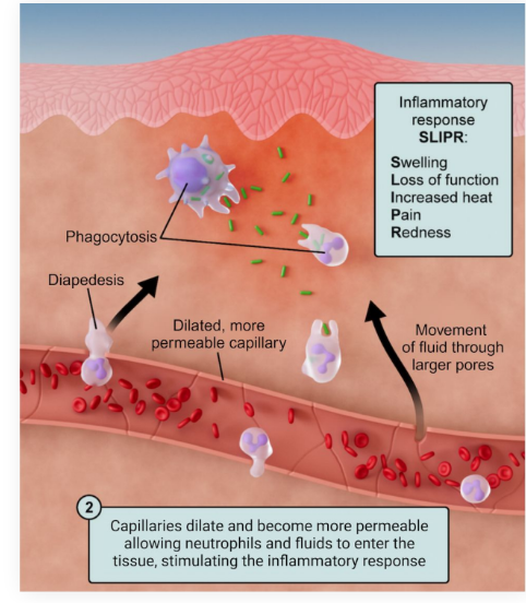 <p>All steps of inflammatory response</p><ul><li><p>What do they do</p></li><li><p>Pnemonic</p></li></ul><p></p>