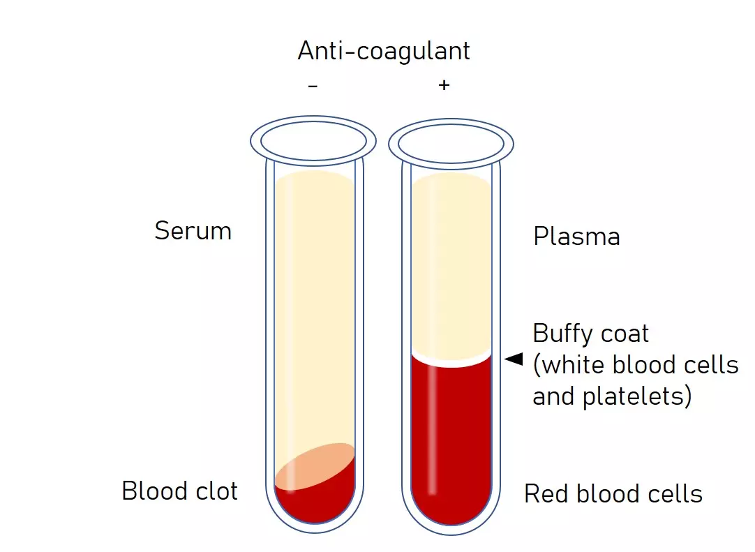 <ul><li><p><span><strong>Plasma</strong> is the liquid part of blood <strong>with clotting factors still present</strong> (including fibrinogen).</span></p></li><li><p><span><strong>Serum</strong> is the liquid part of blood <strong>after clotting has occurred</strong>, so <strong>clotting factors are removed/used up</strong>.</span></p></li></ul><p></p>