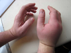<p>these hands</p>