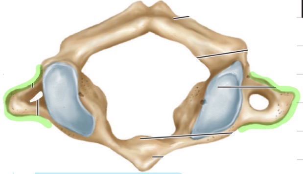 <p>What is the name of this vertebrae?</p>
