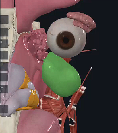term image
