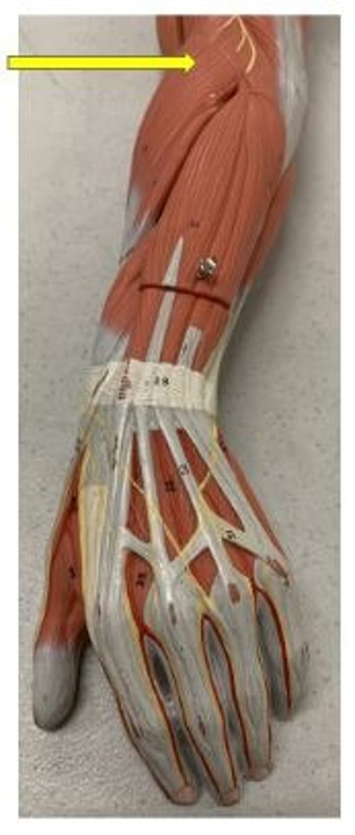 <p>flexes forearm at elbow</p>