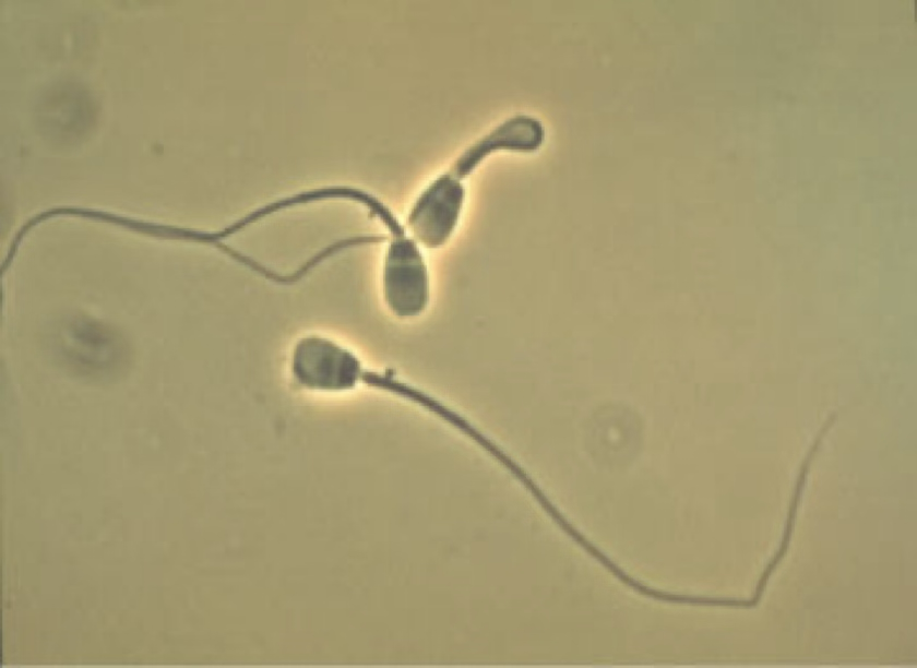 <ul><li><p>Occasionally seen in the sediment of intact male animals or recently bred females.</p></li><li><p><strong>A large amount in urine can produce a false positive for protein.</strong></p></li></ul><p></p>