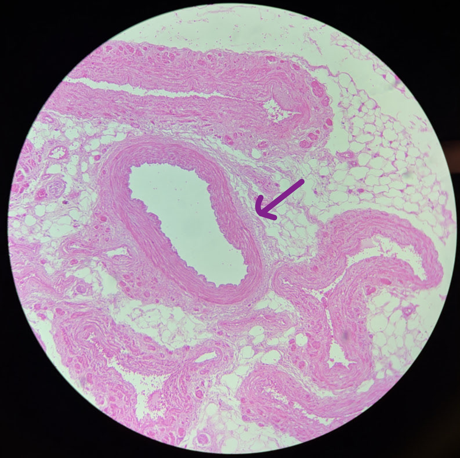 term image