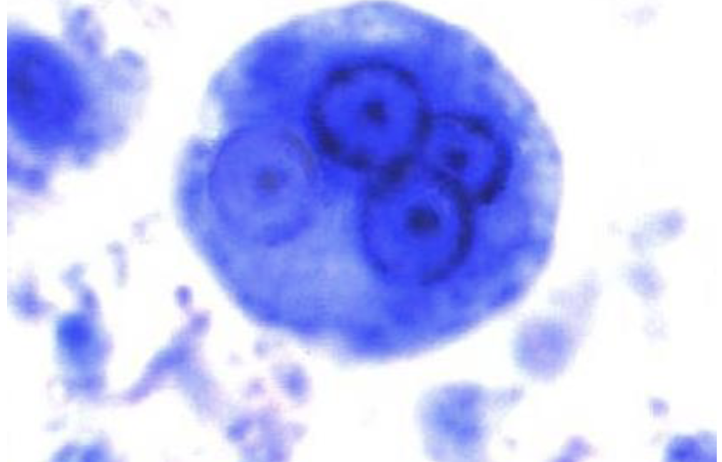 term image