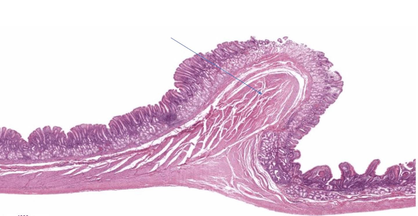 <p>Identify the structure (blue arrow)</p>