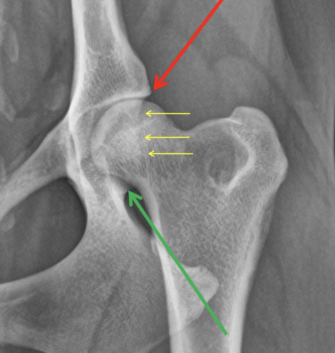 <p>What are the yellow arrows pointing to?</p>