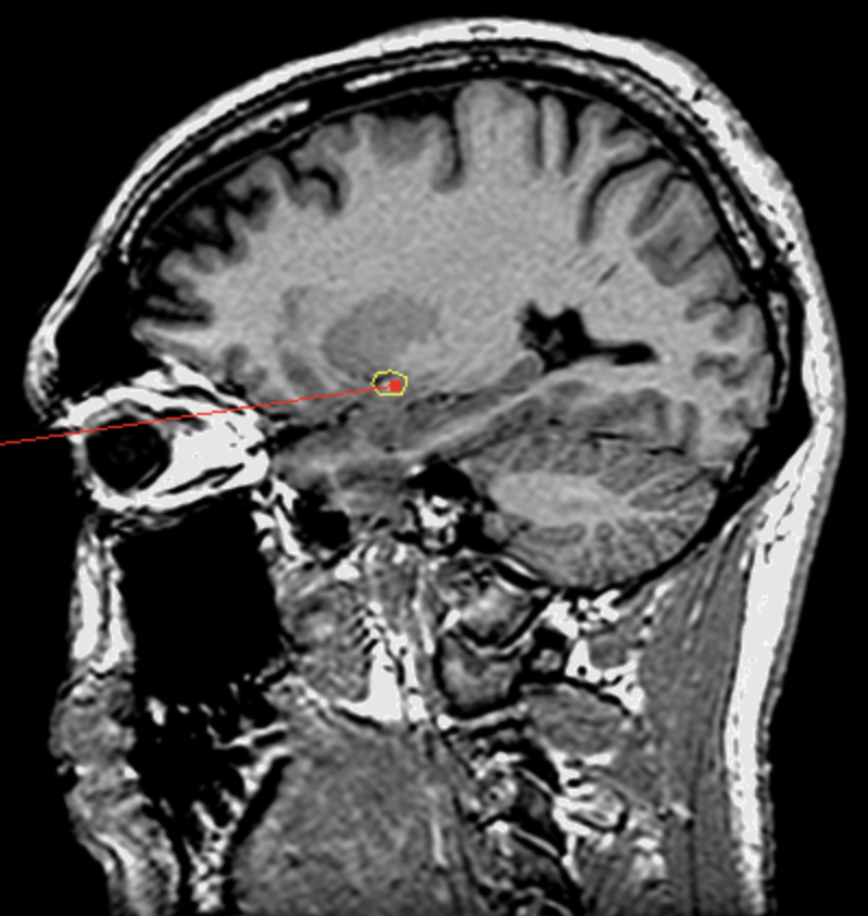<p>What is the area highlighted called?</p>