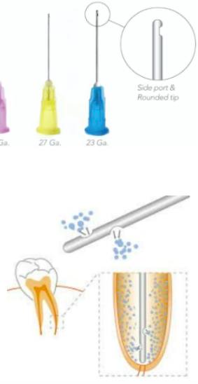 <p>23 gauge</p><p><span><span>to flush out debris or root canals in a </span></span><span style="color: red;"><span>whirlpool effect</span></span><span><strong><span> </span></strong><span>w/out hitting the apical foramen = </span></span><span style="color: red;"><span>efficient cleaning</span></span></p>