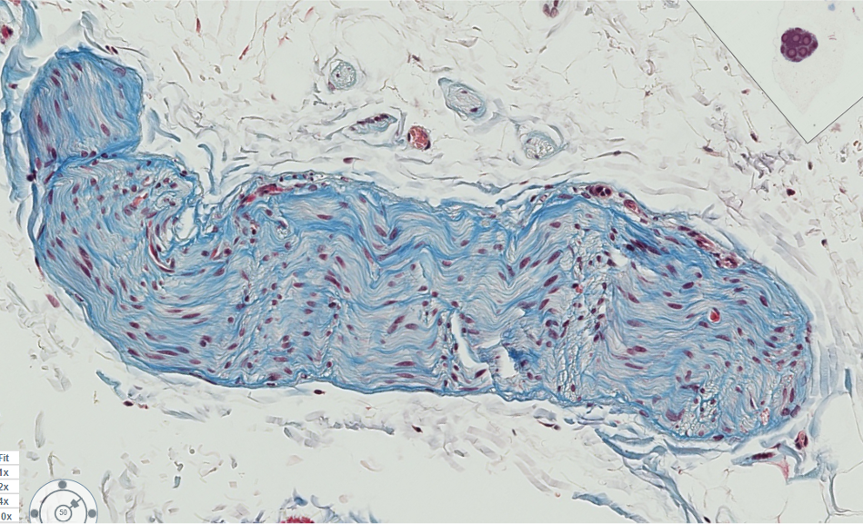 <p><span style="font-family: "Calibri Light";">Is this nerve fascicle myelinated or unmyelinated?</span></p>