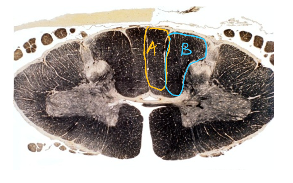 <p>Consider A and B. What is the purpose and Describe the path of the neurons.</p>