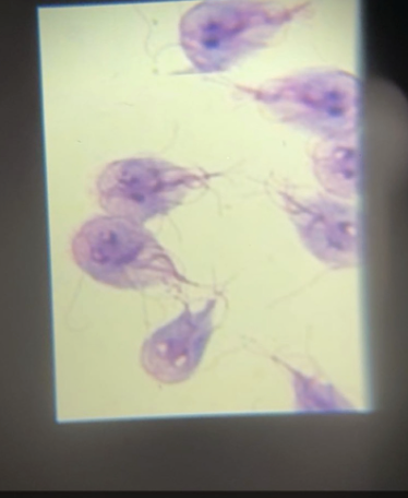 <p><span style="background-color: transparent; font-family: "Times New Roman", serif;">&nbsp;Giardia Lamblia</span></p>
