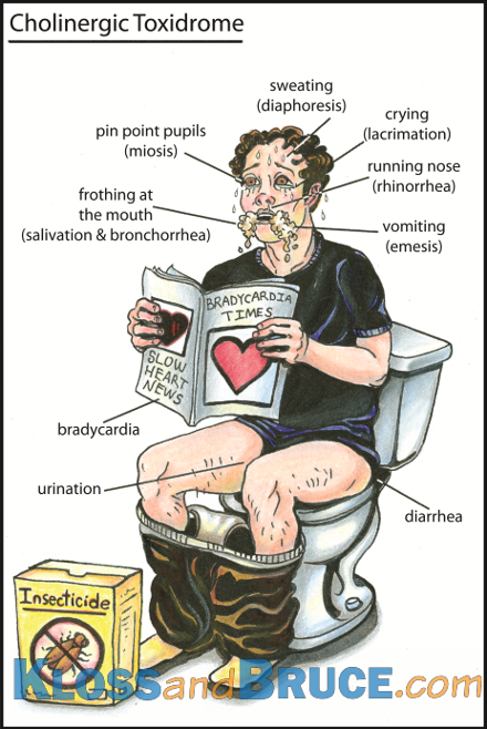 <p>SLUDGE</p><ul><li><p>Salivation </p></li><li><p>Lacrimation </p></li><li><p>Urination </p></li><li><p>Defecation </p></li><li><p>GI distress</p></li><li><p>Emesis </p></li></ul><p>Killer B’s</p><ul><li><p>Bradycardia </p></li><li><p>Bronchorrhea </p></li><li><p>Bronchospasm </p></li></ul><p></p>