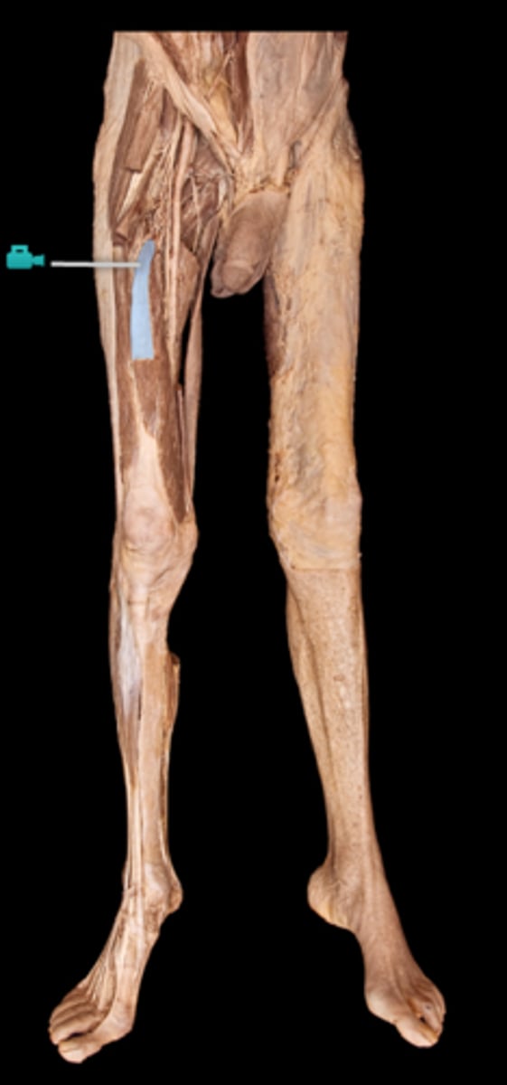 <p>What muscle is this?</p>