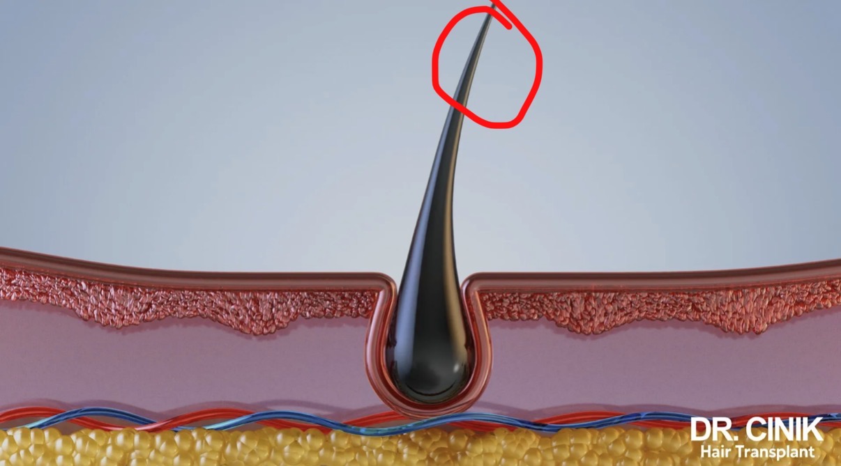 <p>What part of the hair follicle is this? </p>