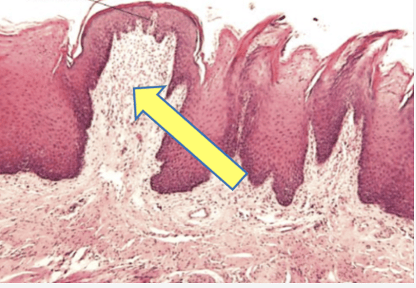 <p>Identify the following structure of the tongue</p>