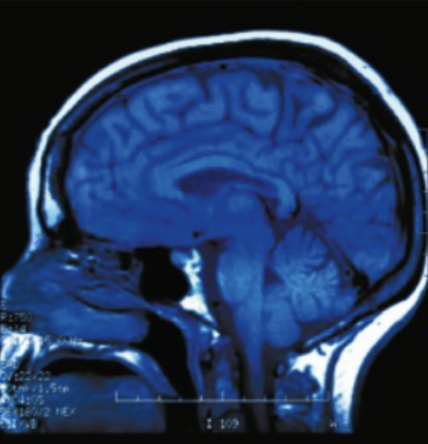 <p><span>produces high-resolution images using radio frequency energy</span></p>