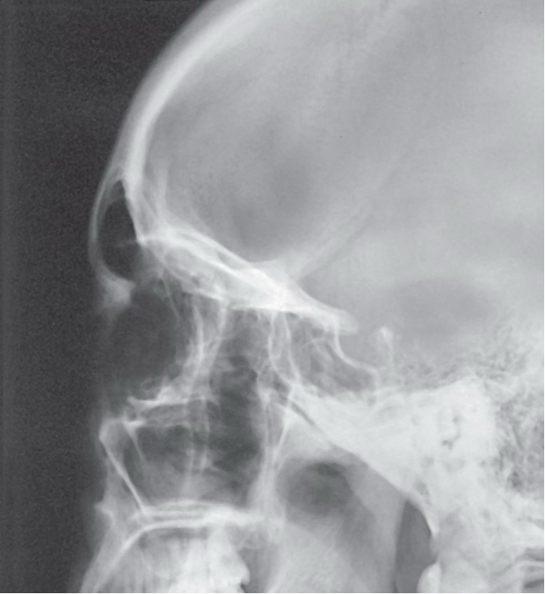 <p>What view is this?</p>