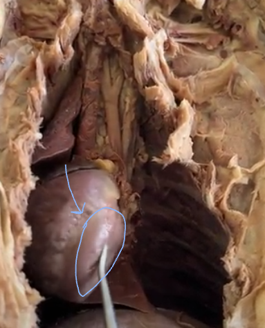 <p>pump blood away from the heart</p>