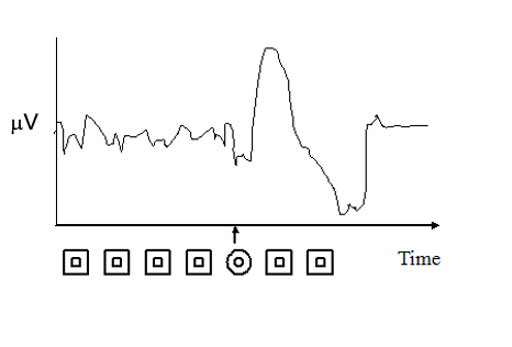 <p>Key Term: Evoked potential </p>