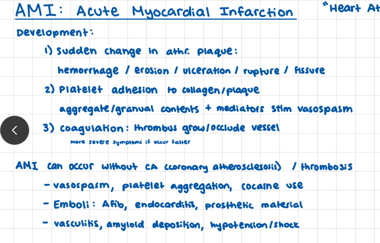 <p>can occur without coronary atherosclerosis</p>