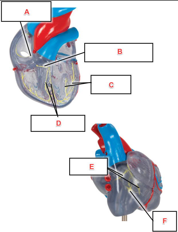 <p>Structure "A" in the image below is called:</p>